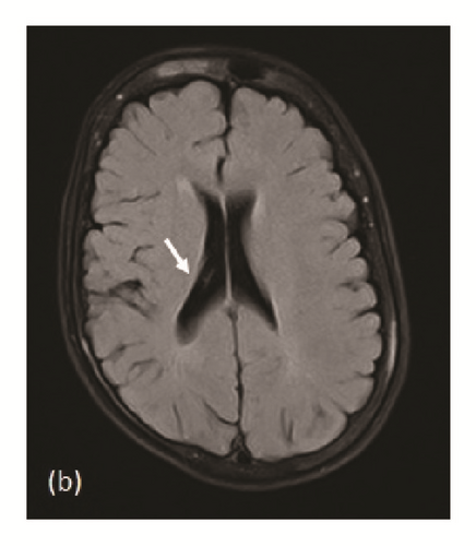 Details are in the caption following the image