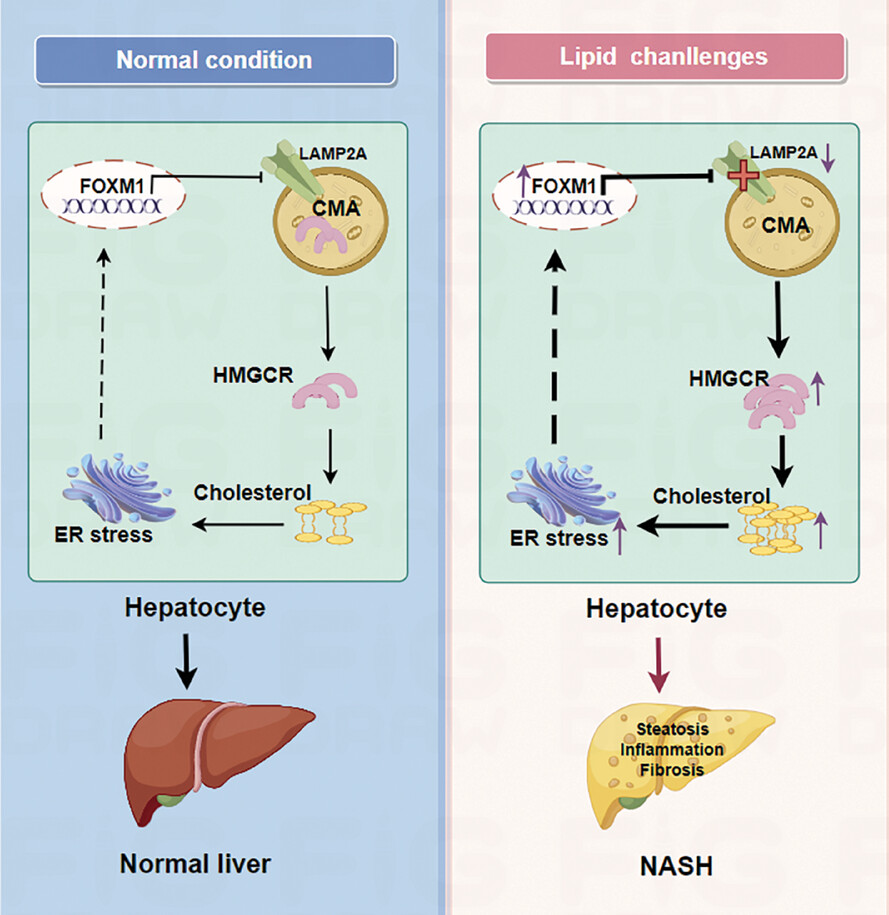 Role of the FOXM1/CMA/ER stress axis in regulating the progression of nonalcoholic steatohepatitis
