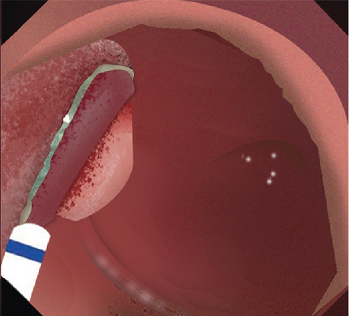 Details are in the caption following the image Details are in the caption following the image