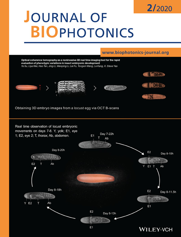 Inside Cover: Optical coherence tomography as a noninvasive 3D real time imaging tool for the rapid evaluation of phenotypic variations in insect embryonic development (J. Biophotonics 2/2020)
