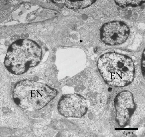 Details are in the caption following the image