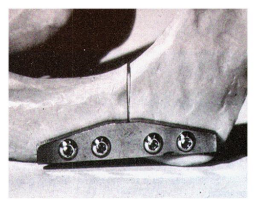 Details are in the caption following the image