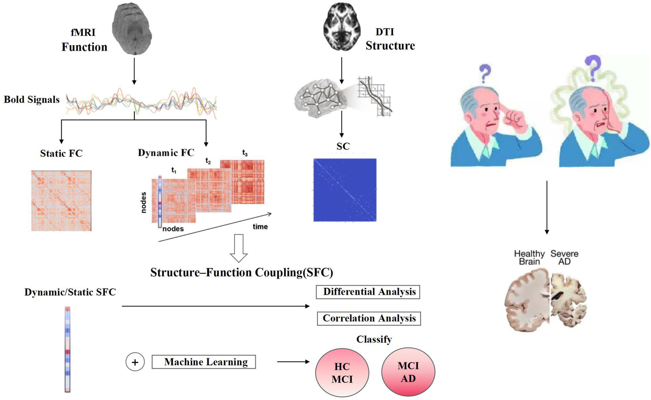 Dynamic and Static Structure–Function Coupling With Machine Learning for the Early Detection of Alzheimer's Disease