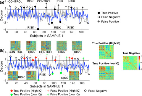 Neonatal brain connectivity outliers identify over forty percent of IQ outliers at 4 years of age