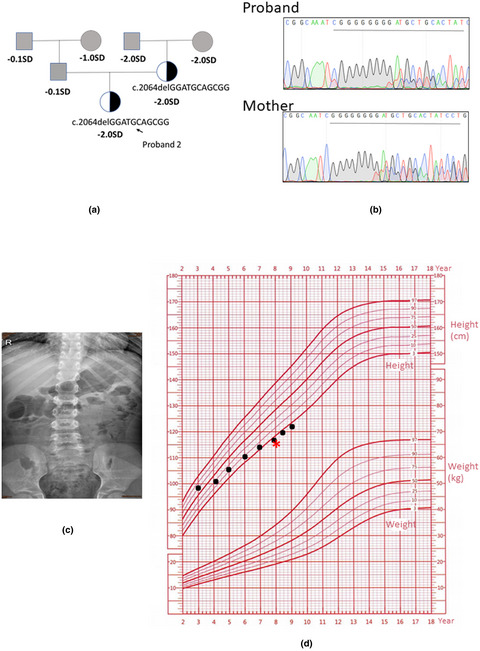 A novel mutation in NF1 gene of patient with Neurofibromatosis type 1: A case report and functional study