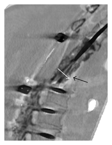 Details are in the caption following the image