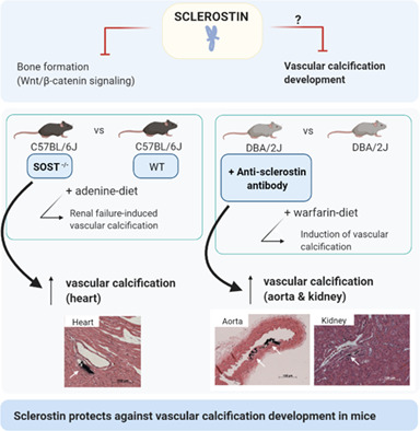 Sclerostin Protects Against Vascular Calcification Development in Mice