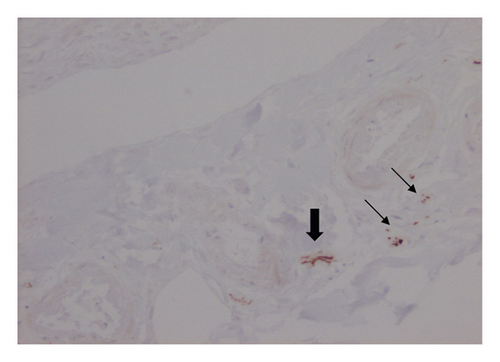Details are in the caption following the image