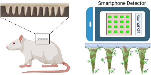 A Hydrogel Microneedle Assay Combined with Nucleic Acid Probes for On-Site Detection of Small Molecules and Proteins