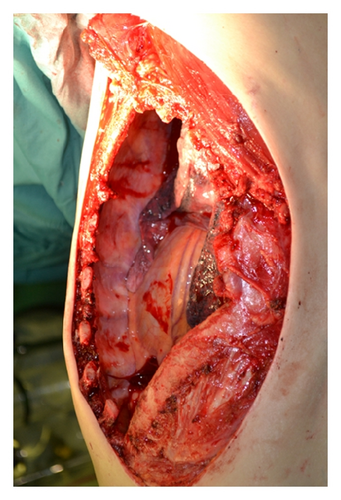 Details are in the caption following the image Details are in the caption following the image