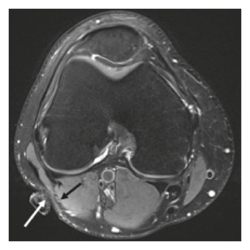 Details are in the caption following the image
