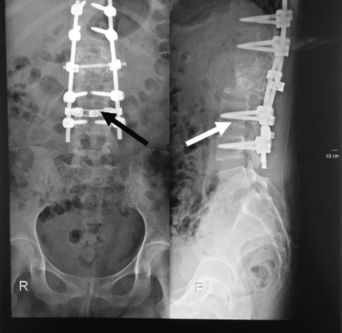 Details are in the caption following the image Details are in the caption following the image