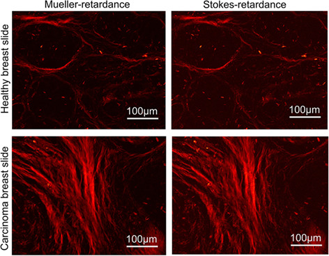 Assessment of tissue polarimetric properties using Stokes polarimetric imaging with circularly polarized illumination