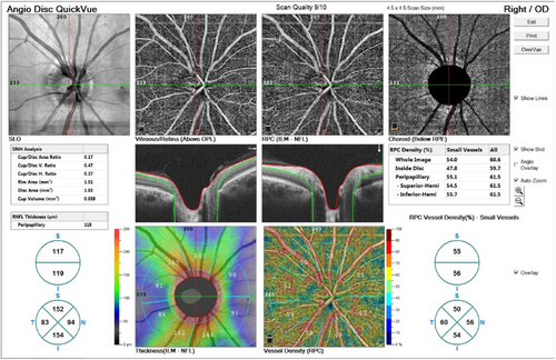 Details are in the caption following the image Details are in the caption following the image