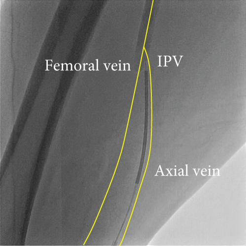Details are in the caption following the image