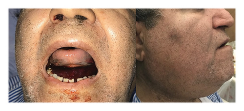 Details are in the caption following the image Details are in the caption following the image