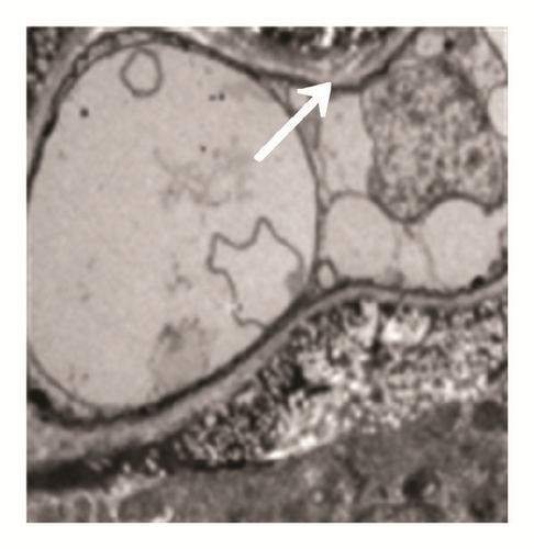 Details are in the caption following the image