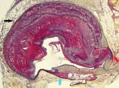 Details are in the caption following the image