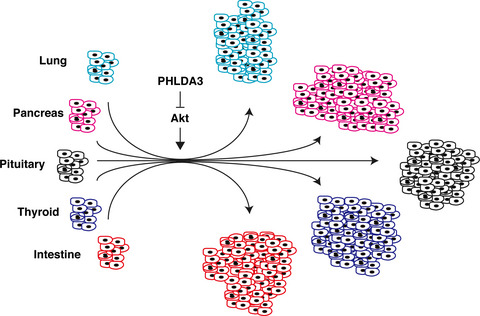 A vicious partnership between AKT and PHLDA3 to facilitate neuroendocrine tumors