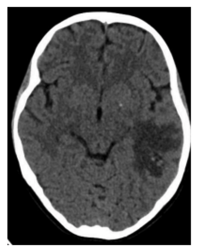 Details are in the caption following the image