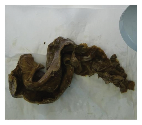 Details are in the caption following the image Details are in the caption following the image