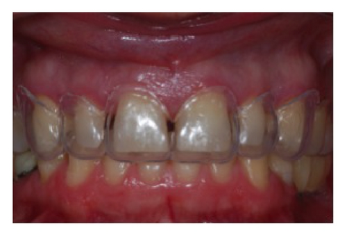 Details are in the caption following the image Details are in the caption following the image