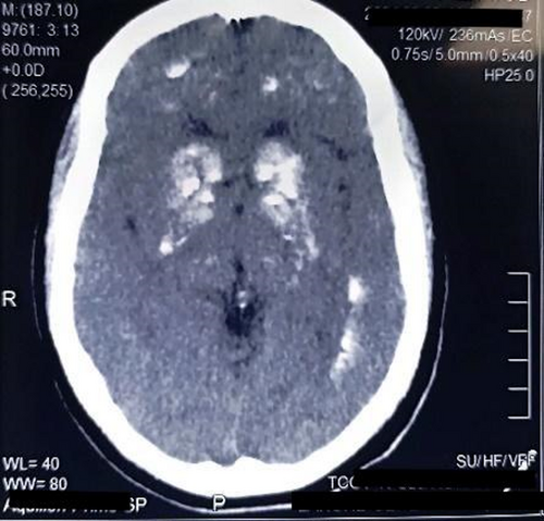 Details are in the caption following the image
