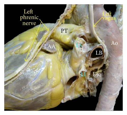 Details are in the caption following the image