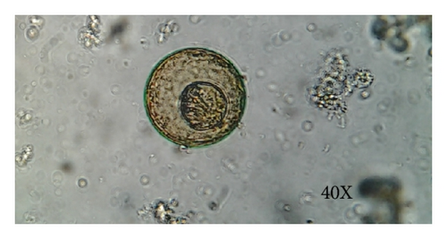 Details are in the caption following the image