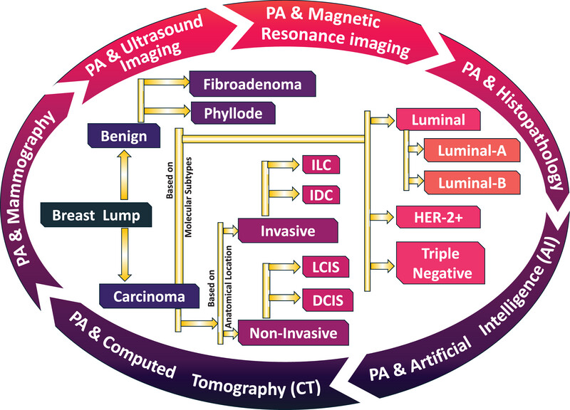 Photoacoustic integrated multimodal imaging for breast cancer diagnosis: A review Issue ,