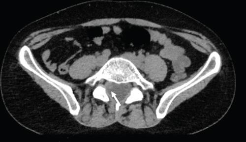 Details are in the caption following the image