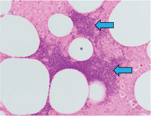 Details are in the caption following the image