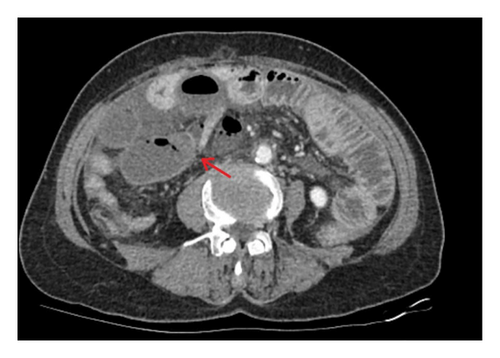 Details are in the caption following the image Details are in the caption following the image