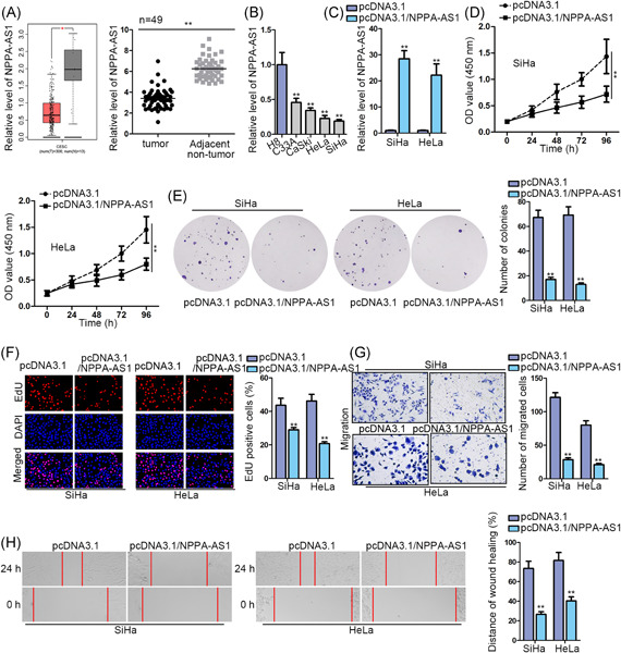 REST-repressed lncRNA NPPA-AS1 regulates cervical cancer progression by modulating miR-302e/DKK1/Wnt/β-catenin signaling pathway