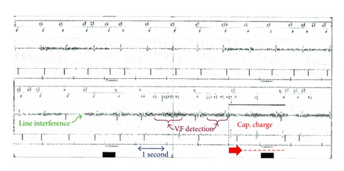 Details are in the caption following the image