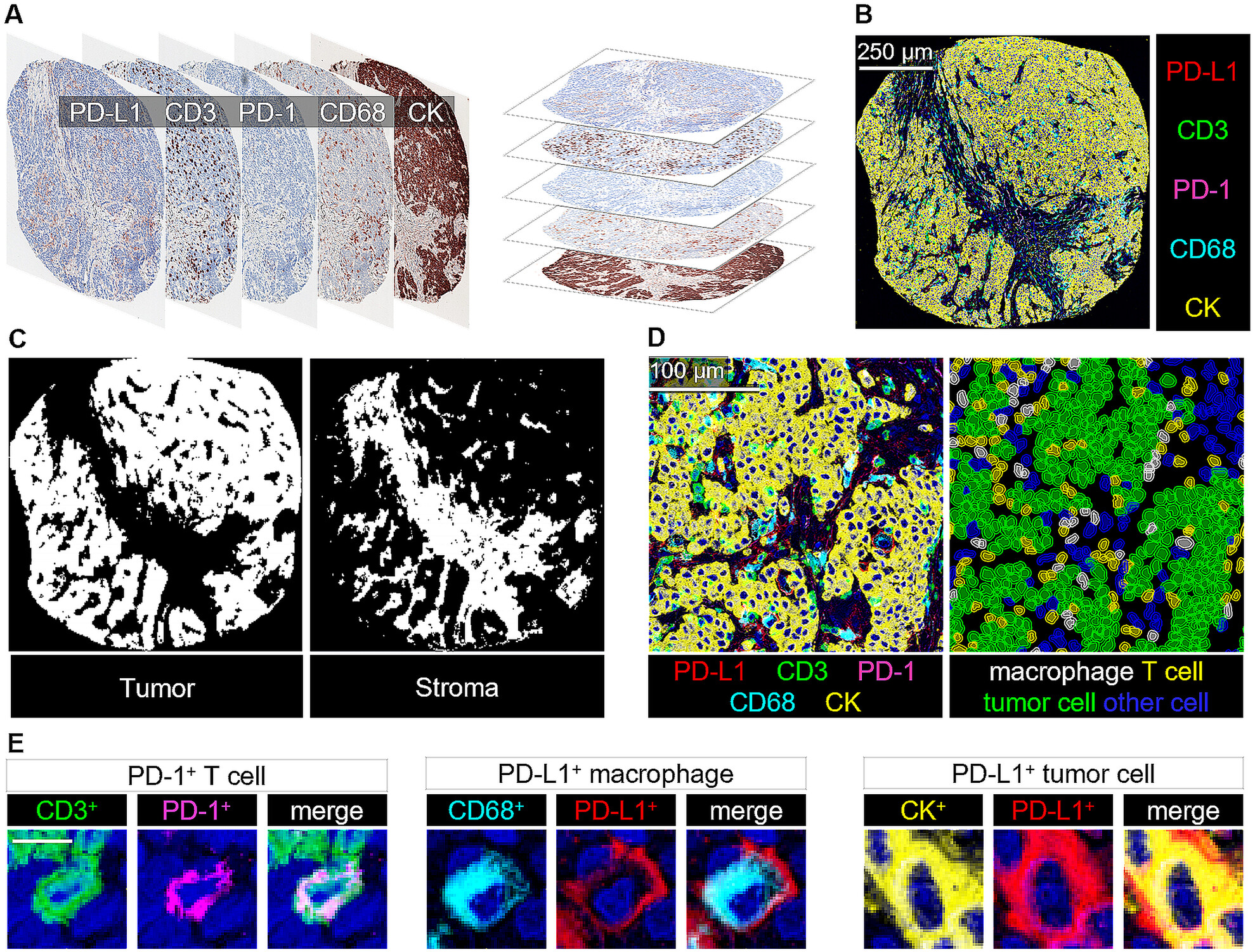 Prognostic Features and Potential for Immune Therapy in Metastatic Mismatch Repair-Deficient Colorectal Cancer: A Retrospective Analysis of a Large Consecutive Population-Based Patient Series