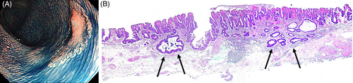 Details are in the caption following the image Details are in the caption following the image