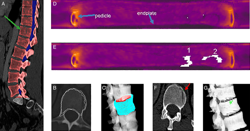 Details are in the caption following the image Details are in the caption following the image