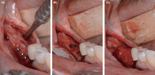 Details are in the caption following the image Details are in the caption following the image