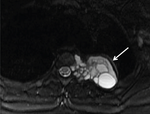 Details are in the caption following the image