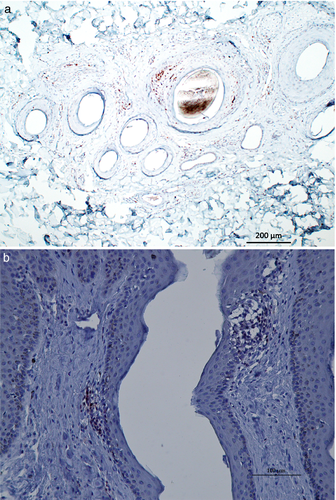 Details are in the caption following the image Details are in the caption following the image