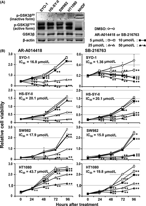 Glycogen synthase kinase 3β as a potential therapeutic target in synovial sarcoma and fibrosarcoma