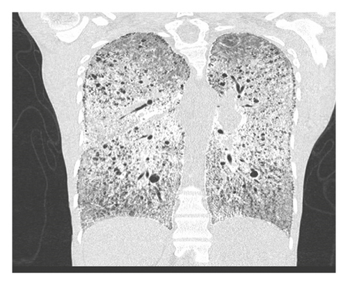 Details are in the caption following the image