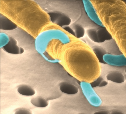 Have an Ion on It: The Life-Cycle of Bdellovibrio bacteriovorus Viewed by Helium-Ion Microscopy