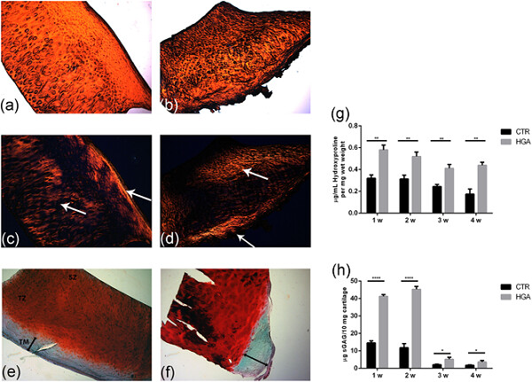 Homogentisic acid induces morphological and mechanical aberration of ochronotic cartilage in alkaptonuria