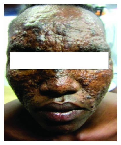 Details are in the caption following the image Details are in the caption following the image