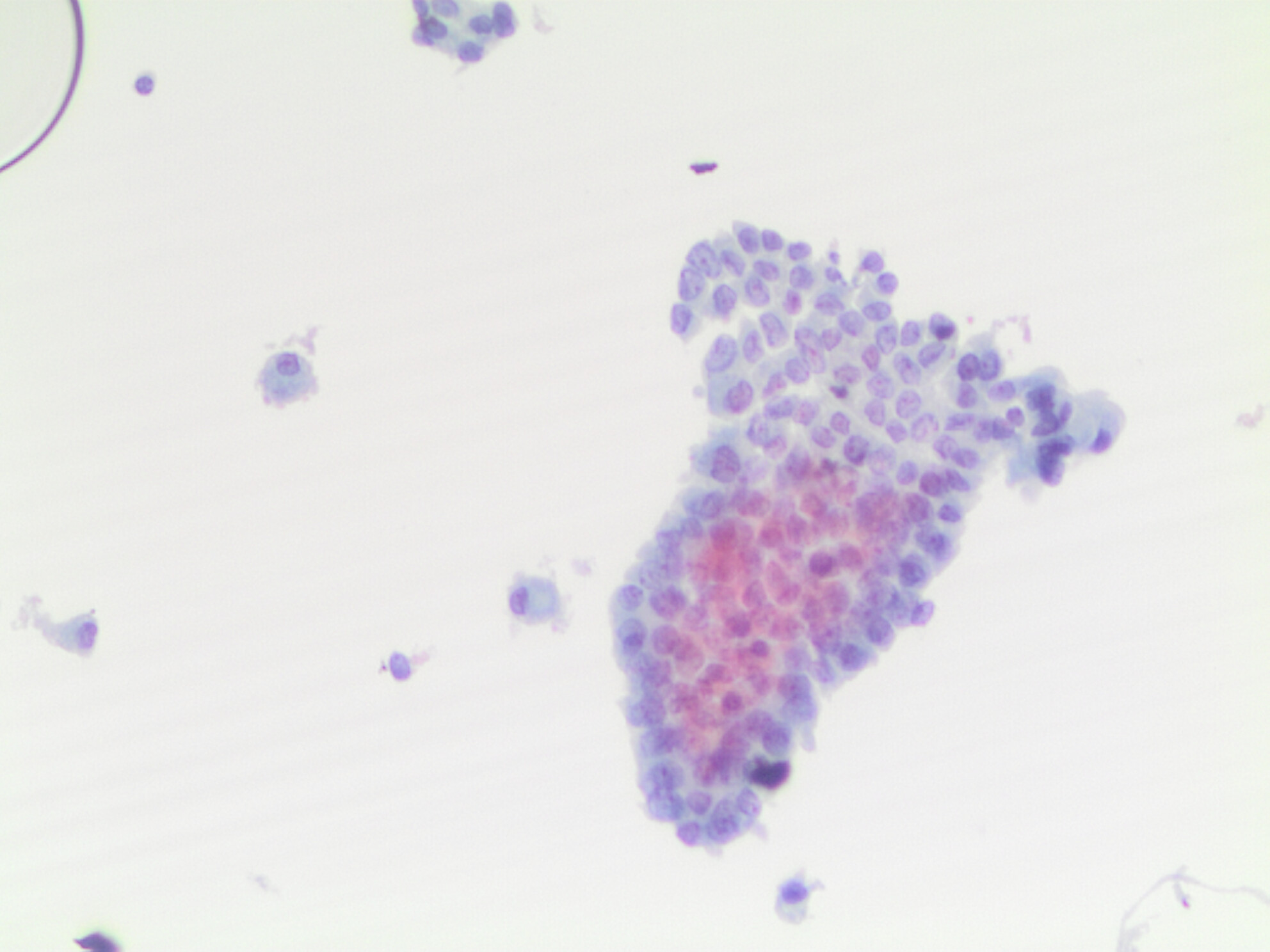 Are we ready to bridge classification systems? A comprehensive review of different reporting systems in thyroid cytology
