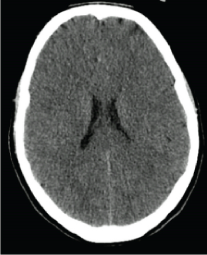 Details are in the caption following the image