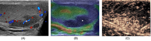 Details are in the caption following the image