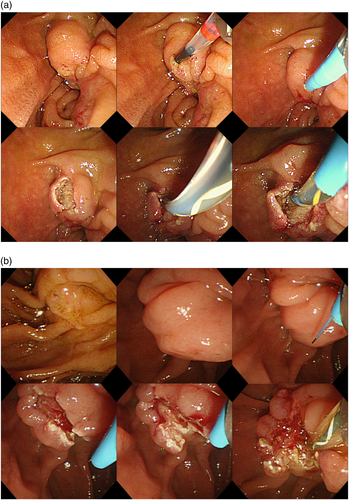 Details are in the caption following the image Details are in the caption following the image